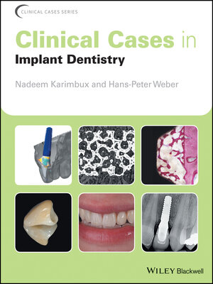 cover image of Clinical Cases in Implant Dentistry